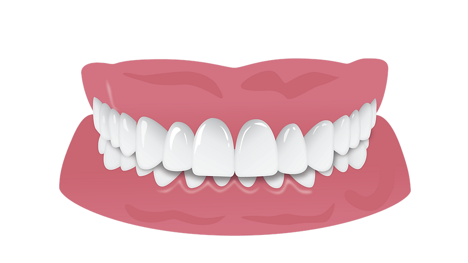 Supraclusion (Deep bite)